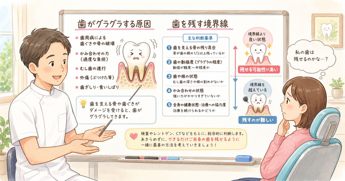 なぜ歯がグラグラするのか？抜歯を判断する境界線と原因