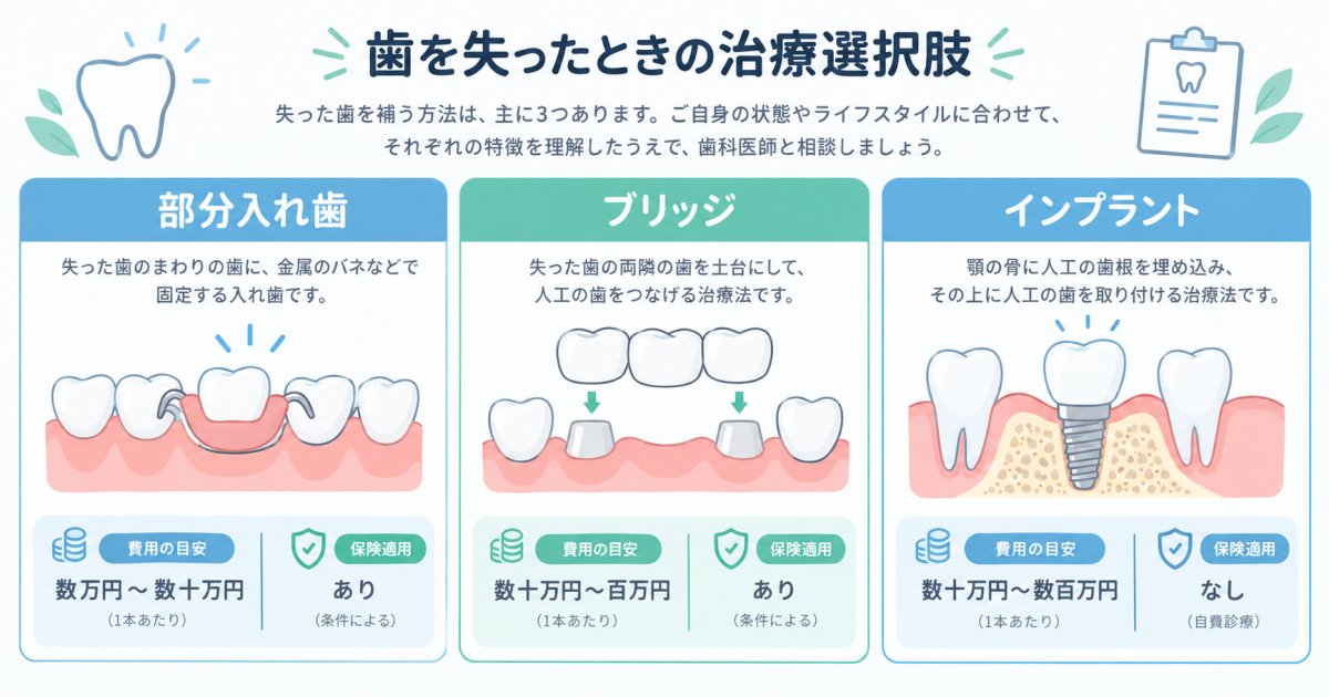 歯を失ったときの治療選択肢｜費用や残る歯への影響の違いを解説