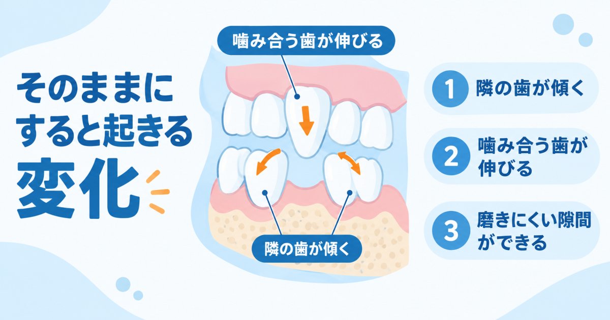 歯が抜けたまま放置すると生じるお口全体のトラブル