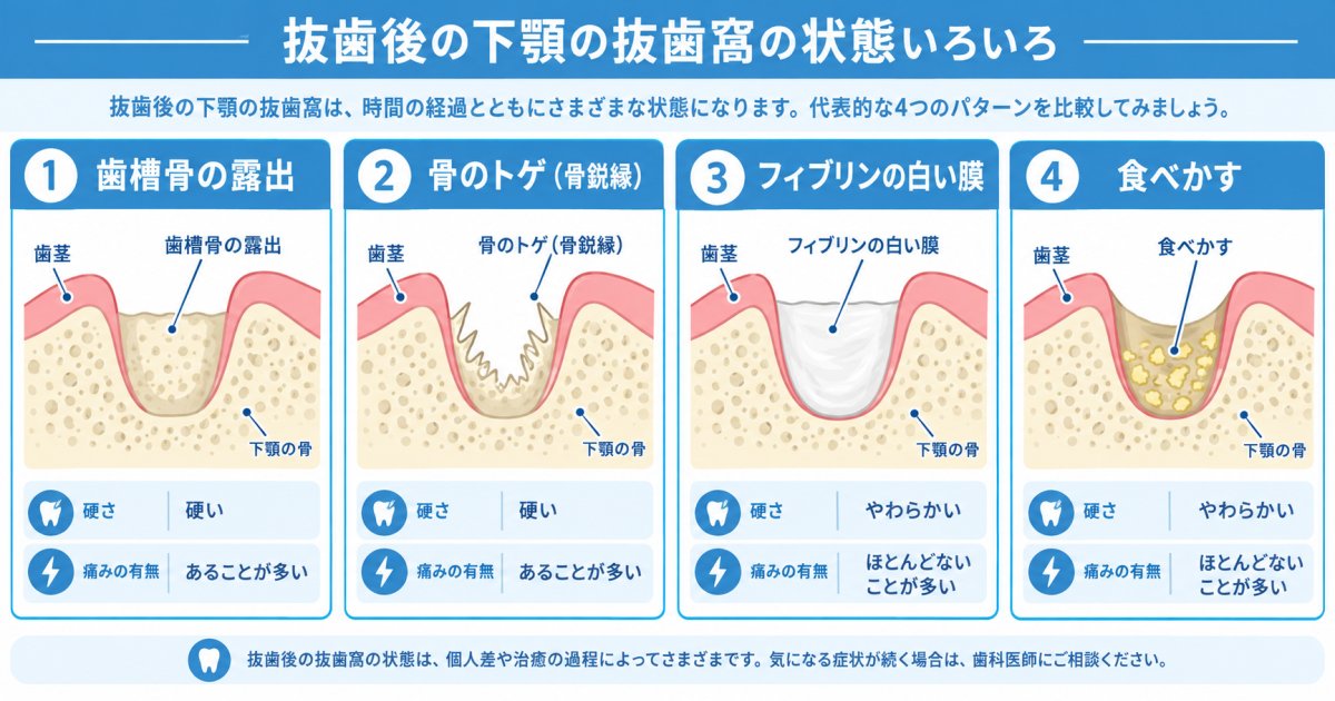 抜歯後に見える白いものの正体を見分ける