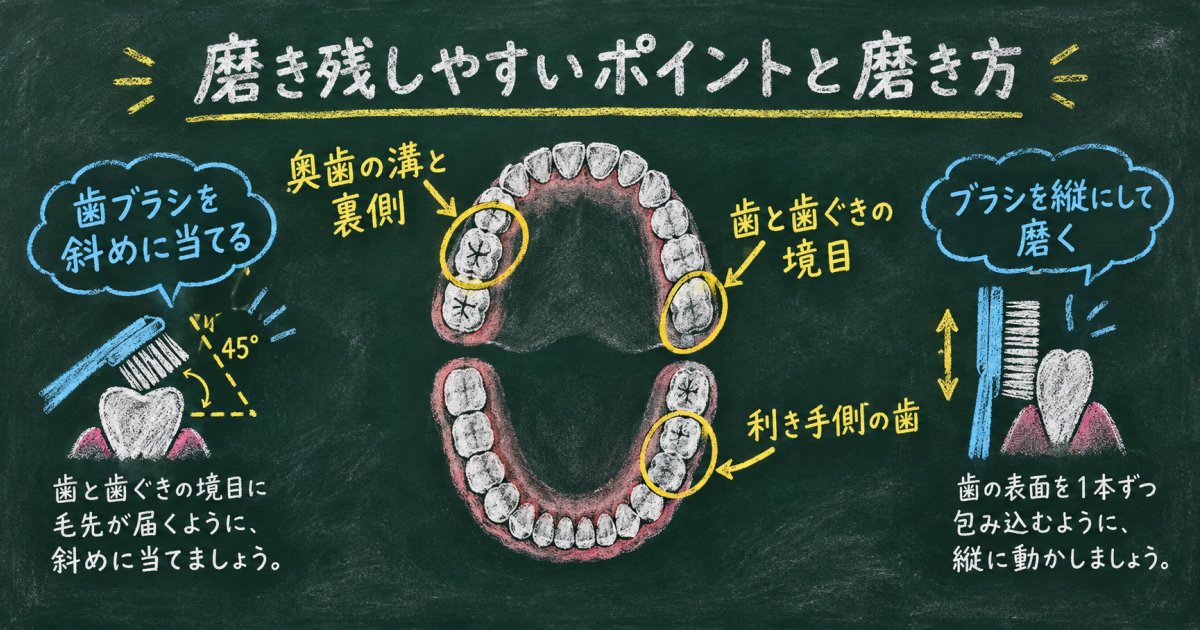 指摘されやすい部位はどこか、磨き残しの起きやすい場所